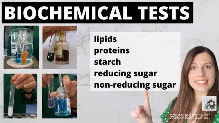 Biochemical tests for food macromolecules labster